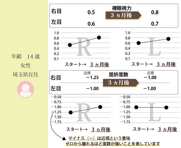 子どもの視力を悪化させない！ – 視力回復ビジョンサロントレーニング  