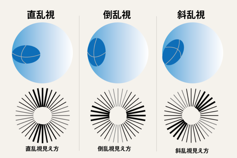 乱視とは? – 視力回復ビジョンサロントレーニングメガネ